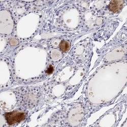 C16orf89 Antibody, Novus Biologicals:Antibodies:Primary Antibodies